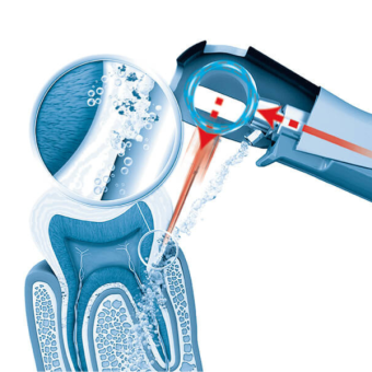 Vector Paro Pro Unit - Next Dental UK